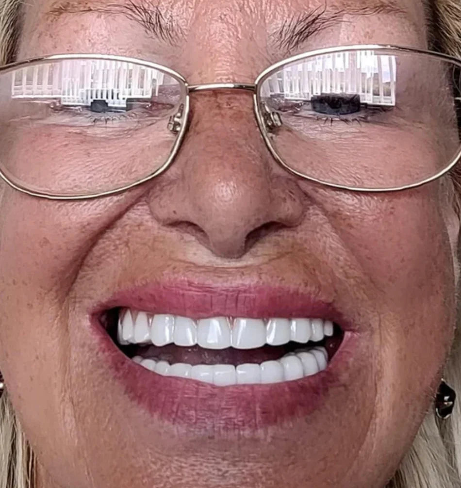 Carillas Dentales Snap On Smile - Sonrisa Perfecta + Envio Gratis