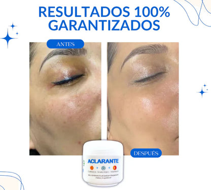 CREMA ACLARADORA ¡DILE ADIOS A LAS MANCHAS Y LUCE UNA PIEL RADIANTE! +  ENVIO GRATIS